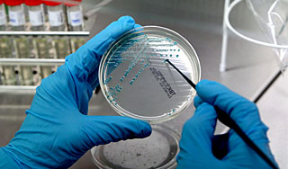 ����������� E. coli ���� � �������� ����